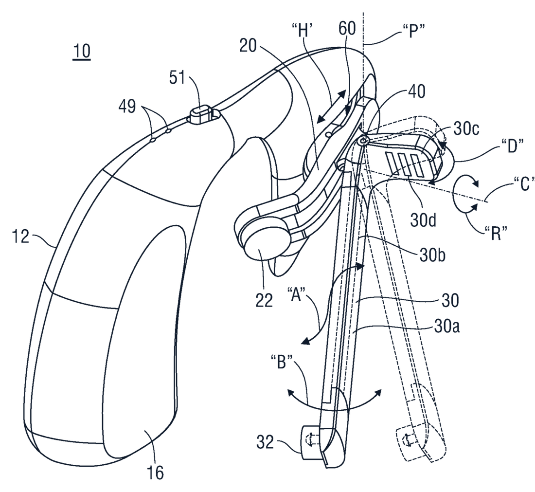 Patent drawing of the auricular stimulation device: a curved behind-the-ear housing with a hinged arm carrying an electrode